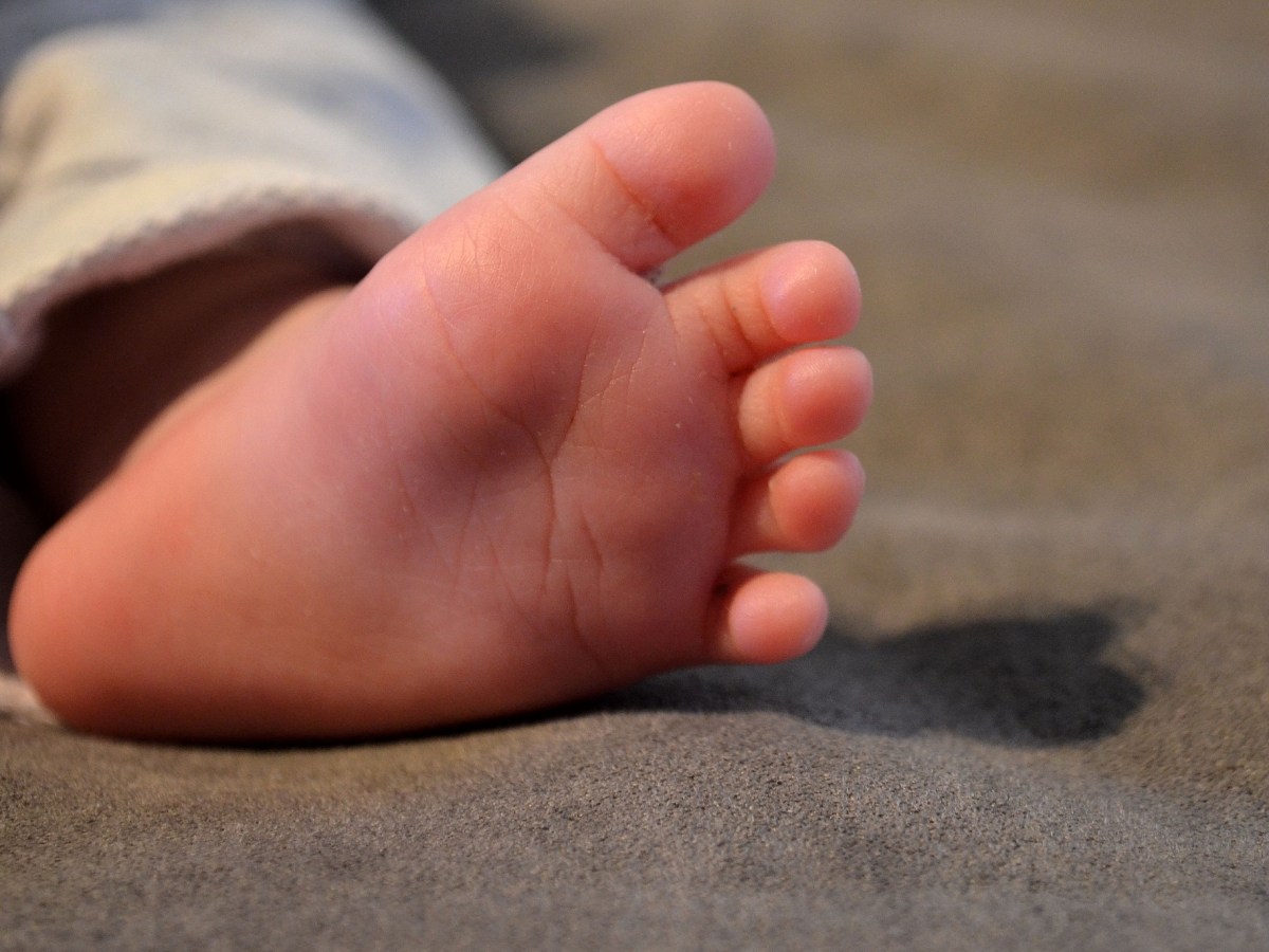 Babyfoot foot peels, a stage by stage break down